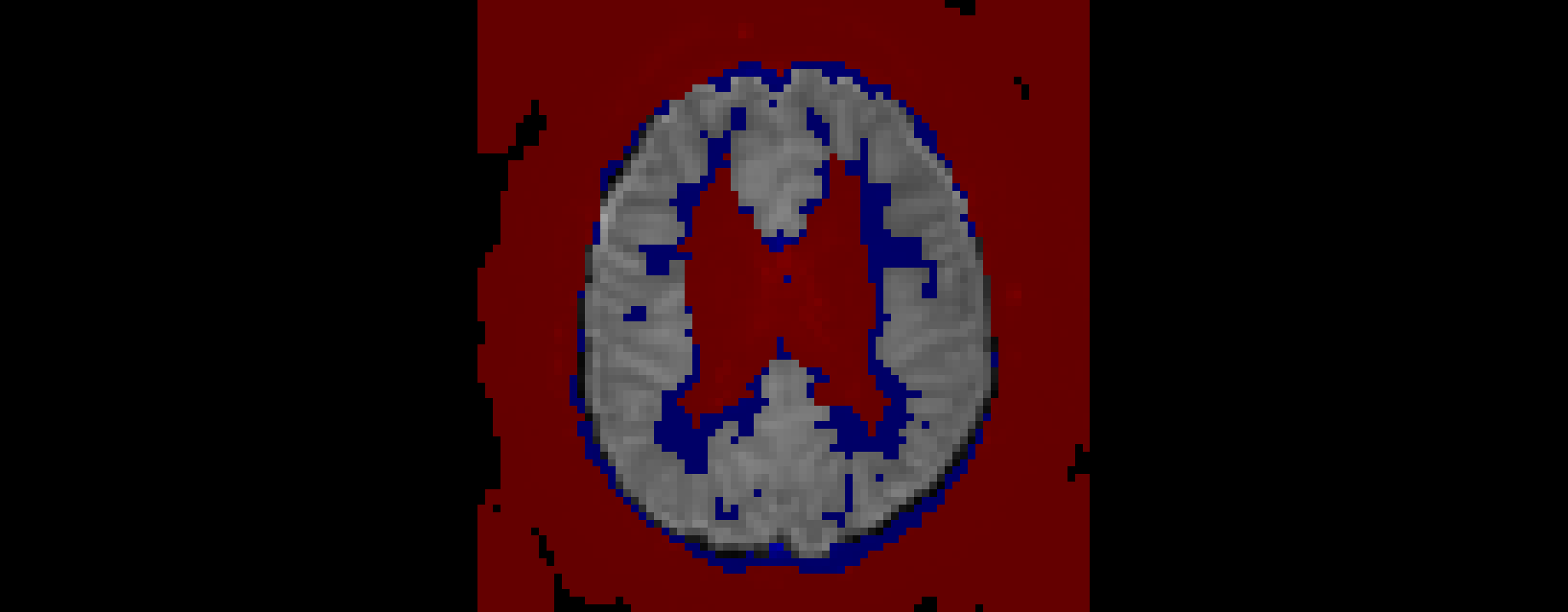../_images/excluded_voxels.png